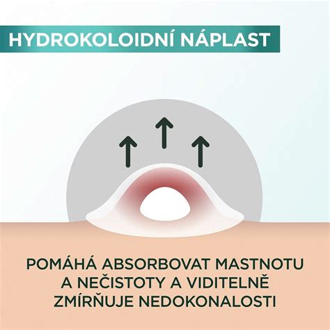 Schéma vrstiev hydrogélovej očnej náplasti a ich účinkov