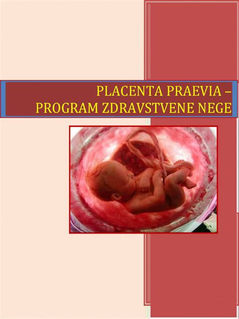 Grafické znázornenie rôznych typov placenta praevia