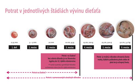 Časové limity pre potrat na Slovensku