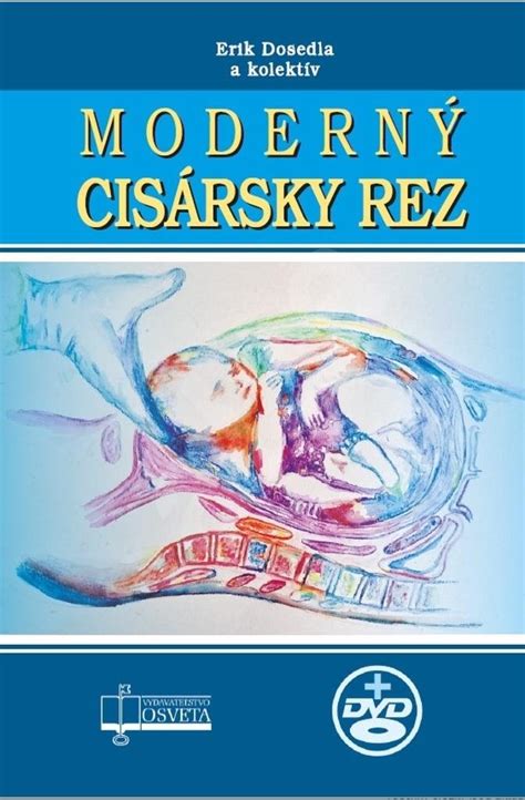 Cisársky rez ako možnosť pôrodu