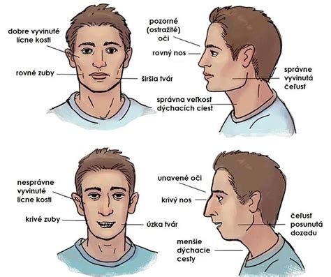 Porovnanie tváre dieťaťa, ktoré dýcha nosom a ústami