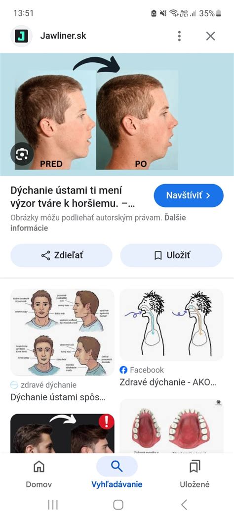 Dieťa so široko otvorenými ústami pri saní Chicco cumlíka