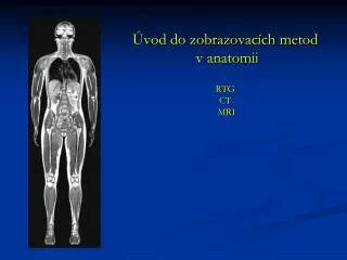 Porovnávacia tabuľka zobrazovacích metód (CT, MRI, USG, RTG)