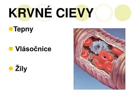 Diagram znázorňujúci zúžené cievy