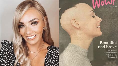 Žena v lekárskom vyšetrení