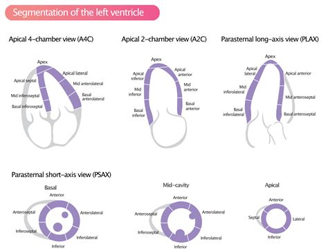 Diagram: Informačné bubliny a echo komory
