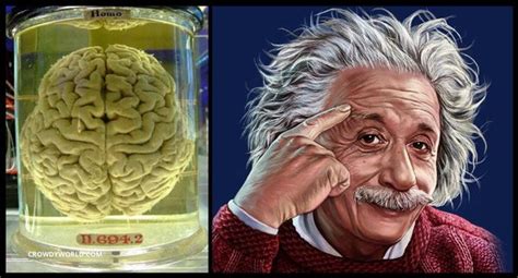 Einsteinov mozog v múzeu