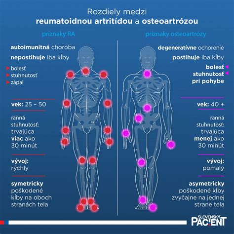 Schéma diagnostických markerov využívaných pri detekcii reumatoidnej artritídy