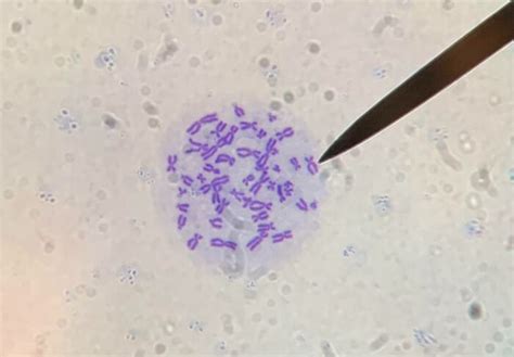 Baktéria Klebsiella pod mikroskopom