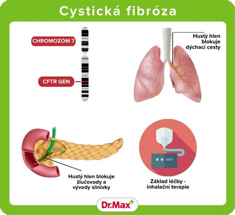Diagram: Ako cystická fibróza postihuje orgány