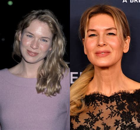 Renée Zellweger pred a po premenou