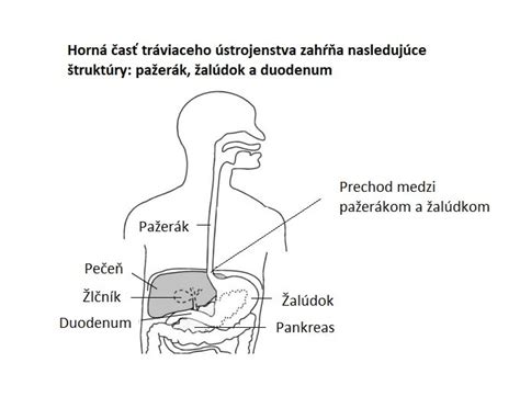 Schéma tráviaceho traktu a miesta krvácania