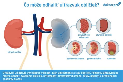 anatómia detského močového systému a proces vylučovania
