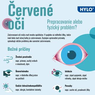Infografika: Hlavné príčiny červených očí