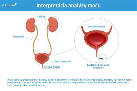 Diagnostika močového systému