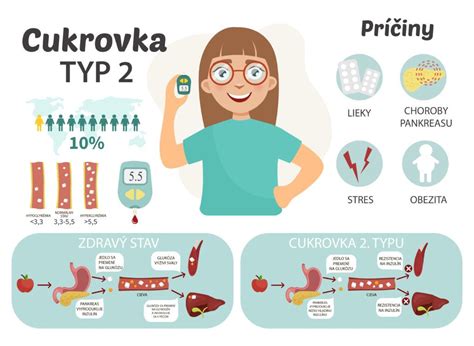 Infografika zobrazujúca vzťah medzi dĺžkou spánku, fyzickou aktivitou a rizikom obezity