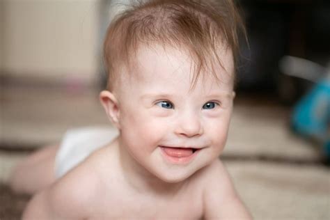 Deti s Downovým syndrómom hrajúce sa