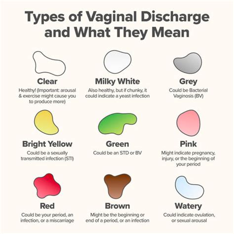Graphic showing different types of normal vs. abnormal vaginal discharge with descriptions