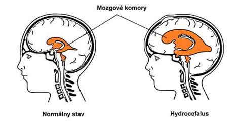 Schéma mozgových komôr a cirkulácie mozgovomiechového moku