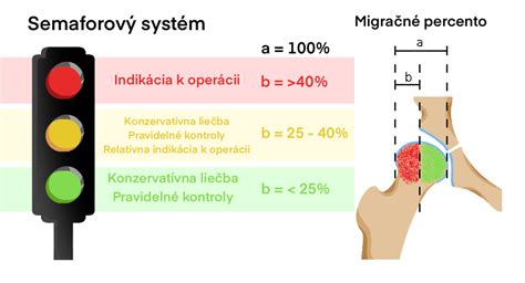 Schéma vnútornej rotácie bedrových kĺbov