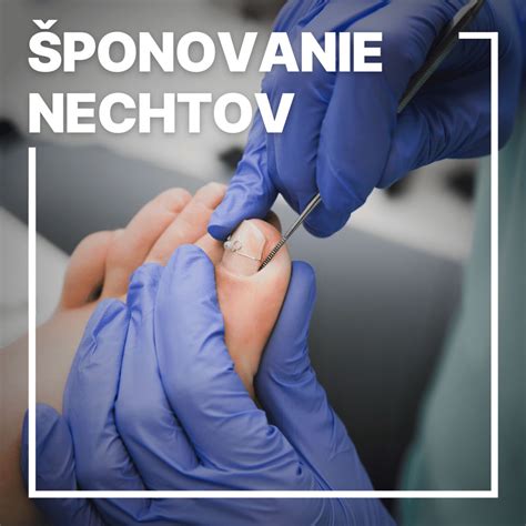 Zlozvyk obhrýzania nechtov