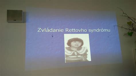 Závažnosť symptómov Rettovho syndrómu
