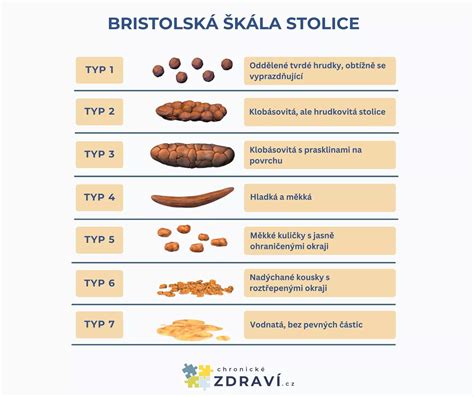 Bristolská škála stolice