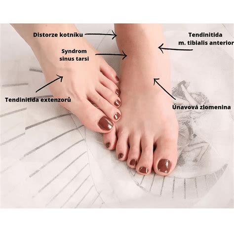 Porovnanie detskej nohy a anatomicky tvarovanej topánky