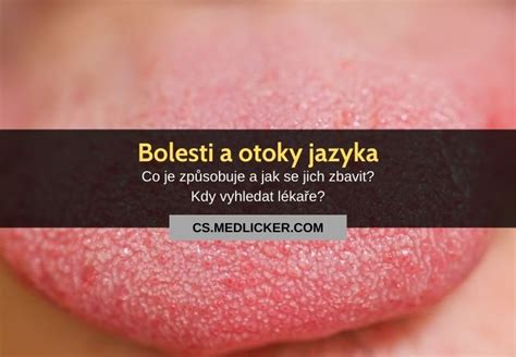 anatómia zdravého jazyka s papilami