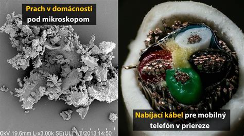 Materské mlieko pod mikroskopom