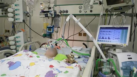 Novorodenec napojený na pľúcny ventilátor s monitormi životných funkcií