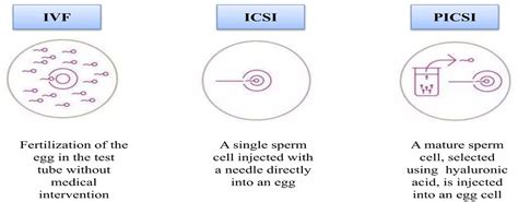 Porovnanie ICSI a PICSI