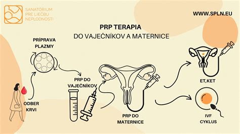Odber vajíčok pod ultrazvukom