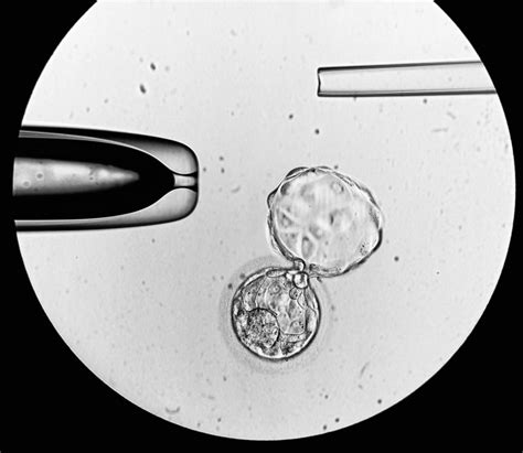 Schéma preimplantačného genetického testovania embrya