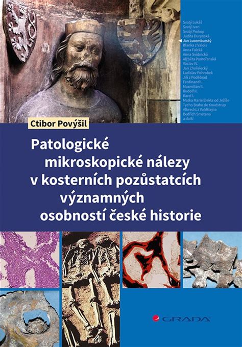 Makroskopické a mikroskopické nálezy patologickej placenty
