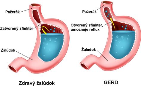 Detský žalúdok a príznaky hladu