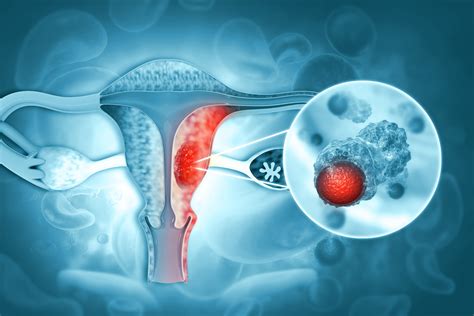 Schéma ženského reprodukčného systému a hlavné oblasti gynekologickej starostlivosti