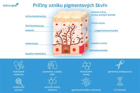 Infografika: Príčiny vzniku hematómov