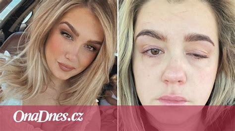Žena oddychujúca po gynekologickom zákroku