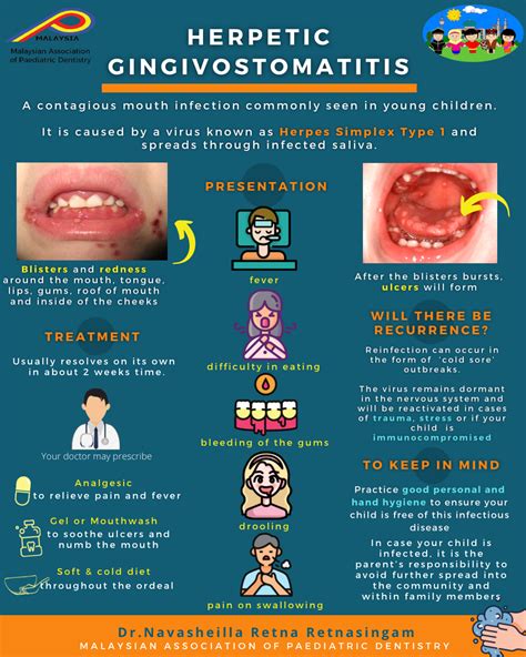 Child with gingivostomatitis