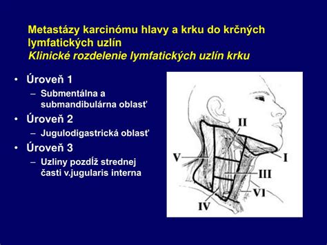 Mapa zväčšených lymfatických uzlín na krku