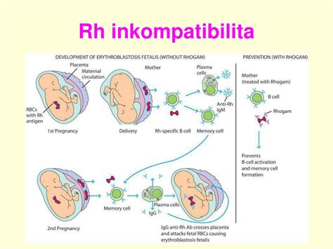Rh inkompatibilita v tehotenstve