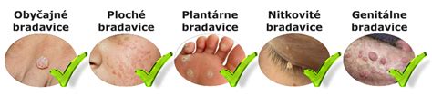 Rôzne typy bradavíc na obrázku