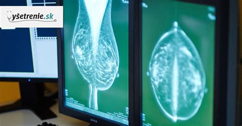 Zobrazenie reprodukčného systému ženy a základných princípov gynekologického vyšetrenia