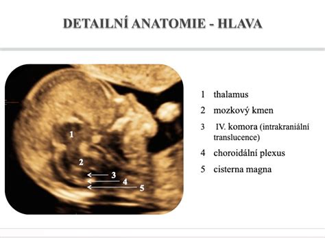 Ultrazvukové merania plodu