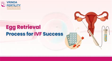 IVF: Egg Retrieval and Fertilization