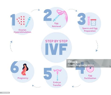 IVF Process Illustration