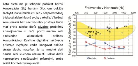 Príklady rôznych pultíkov a madiel ku kočíkom