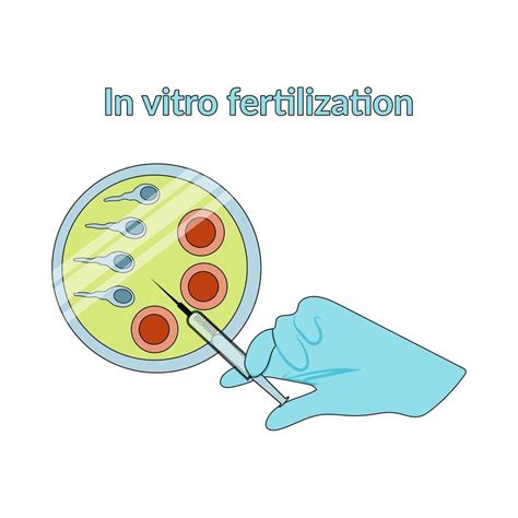 Zjednodušená schéma procesu in vitro fertilizácie (IVF)