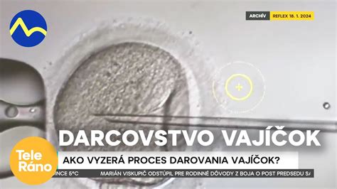 Infografika vysvetľujúca proces zmrazovania vajíčok pre zachovanie plodnosti